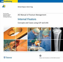 buecher AO Manual of Fracture Management: Internal Fixators (eBook ePUB) von Michael Wagner; Robert Frigg - bücher.de Neuheiten