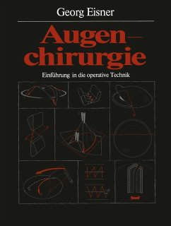 buecher Augenchirurgie (eBook PDF) von Georg Eisner - bücher.de